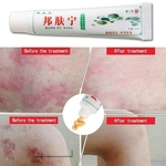 Ficha técnica e caractérísticas do produto 2Pcs Anti Psoríase Creme Corporal Dermatite Eczema Prurido Pomada Tratamento