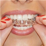 Ficha técnica e caractérísticas do produto Placas Molde para Bruxismo Ranger de Dentes ou Desgaste 1 Par